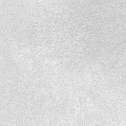 Polipropilene--Gesso